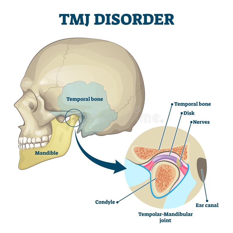 my-jaw-clicks-is-sore-sometimes-how-come-tmd-tmj-dysfunction